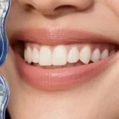 המרכז להשתלות שיניים ד''ר ריאד אבו סלאח